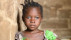 Valentine aus Kamerun ist durch Grauer Star erblindet | Bildquelle: CBM/Tobias Pflanz