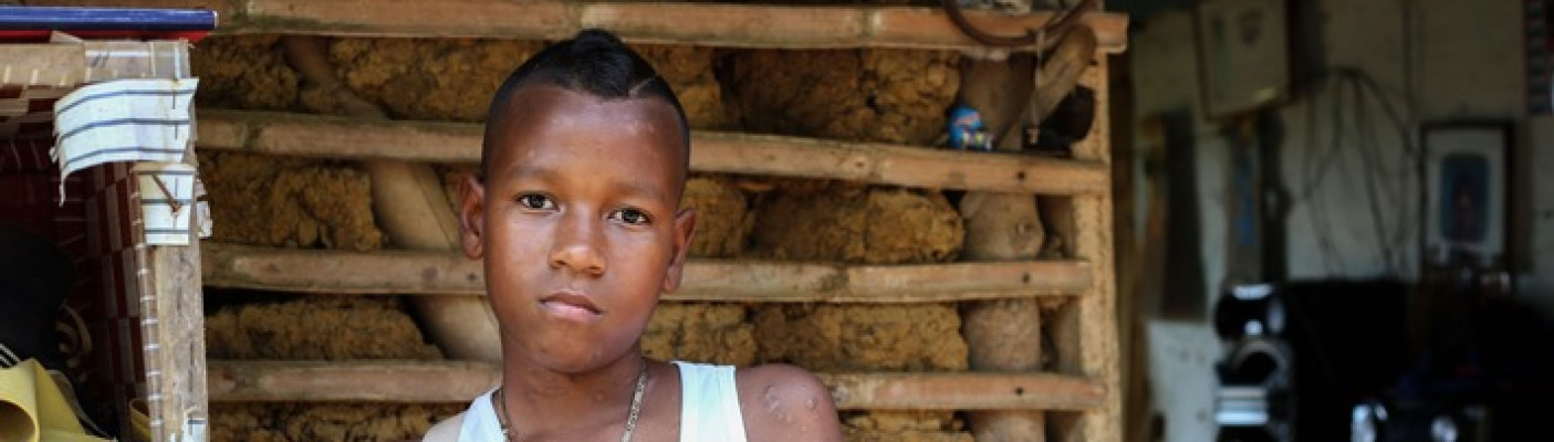 Jemerson aus Kolumbien verlor durch einen Blindg&auml;nger seine linke Hand | Bildquelle: obs/Handicap International/© J.M. Vargas/HI