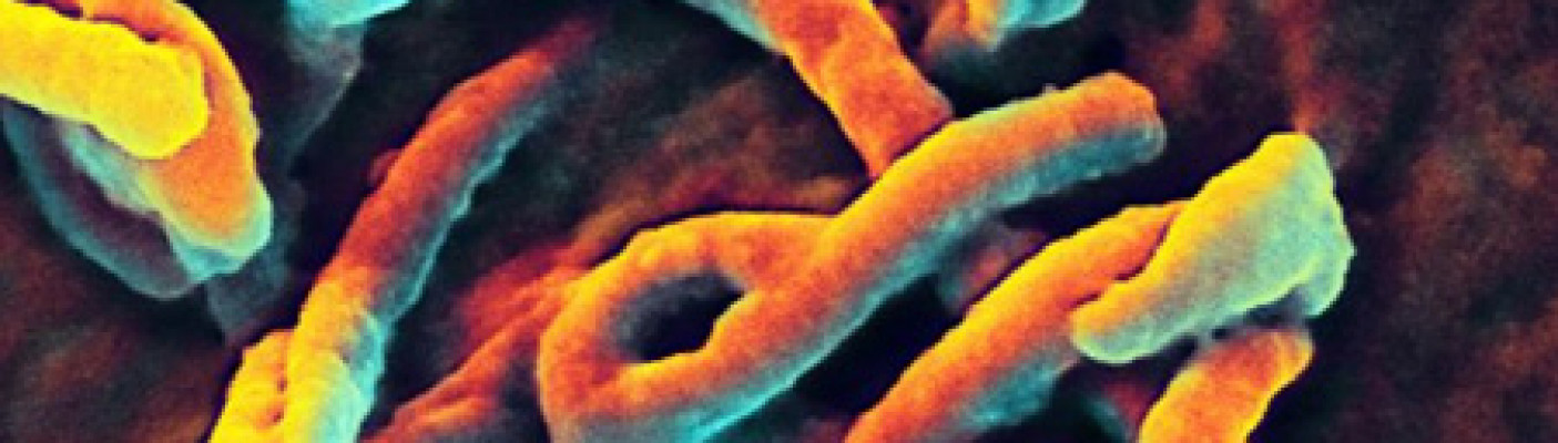 Ebola-Virus unter dem Elektronenmikroskop | Bildquelle: CDC/NIAID (Public Domain)