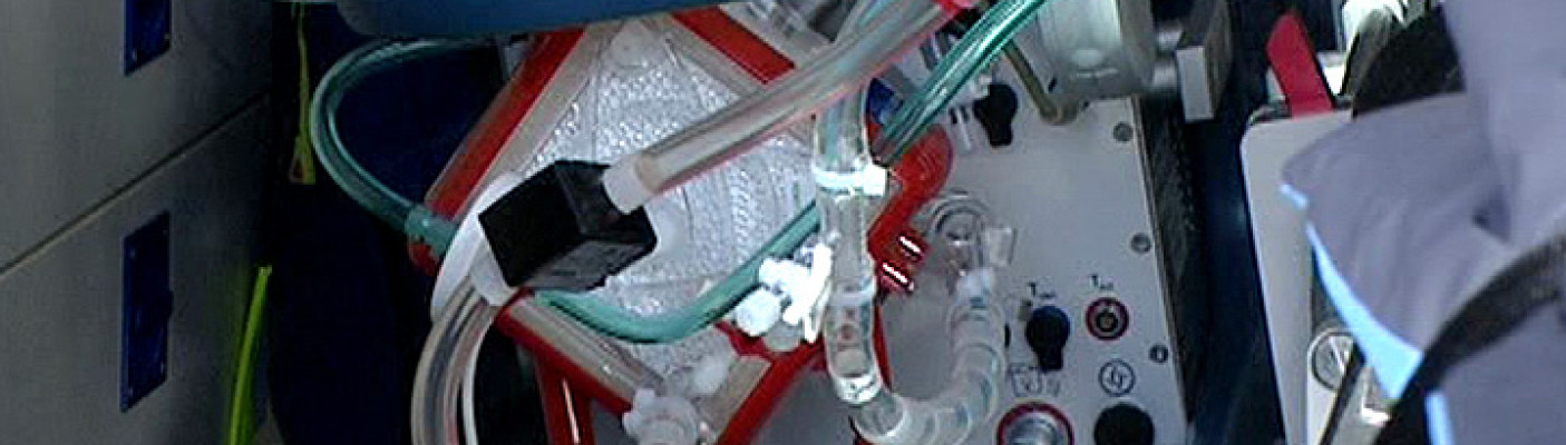 Mobile Herz-Lungen-Maschine | Bildquelle: RTF.1