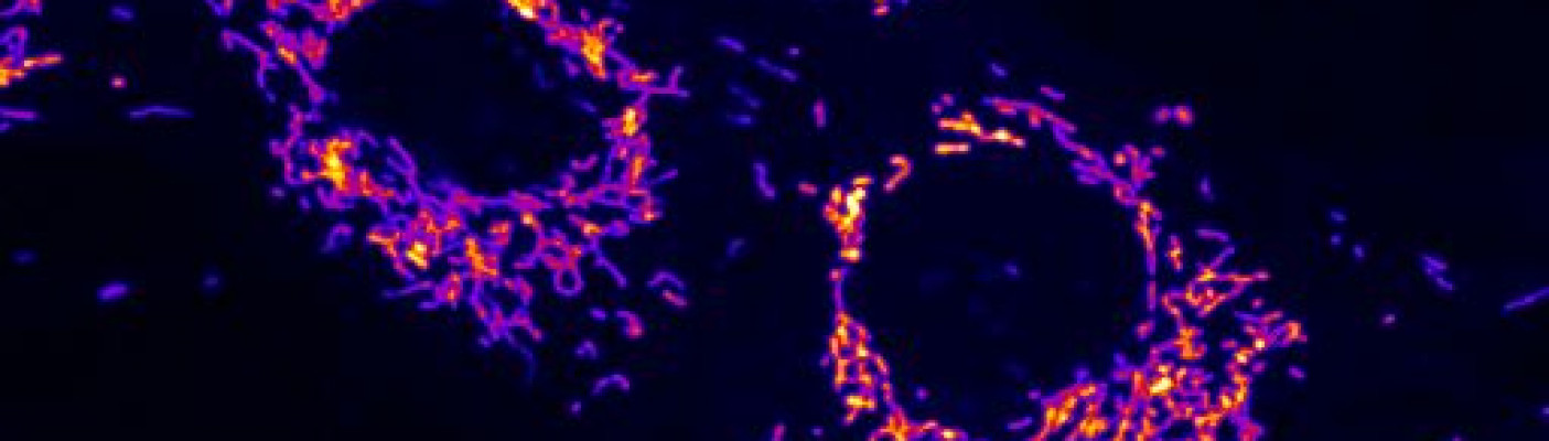 Fluoreszenzmikroskopische Aufnahme von Mitochondrien, die mit einem Farbstoff angefärbt wurden. Bild: Nicola Roverato, Universität Konstanz | Bildquelle: Bild: Nicola Roverato, Universität Konstanz